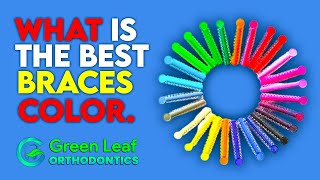 How to Choose the Best Colors for Your Braces  Stylish Braces Color Tips [upl. by Poliard]