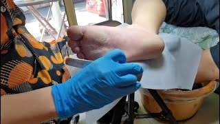 Pedicure  Dead skin removal and Cracked heels treatment Callus removal from feet [upl. by Nyladgam43]