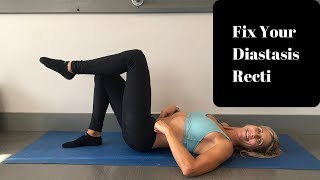 Exercises to Fix Your Diastasis Recti  Physical Therapy [upl. by Ardeed113]