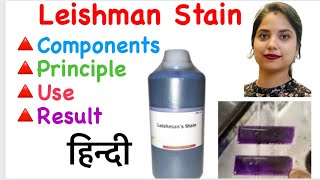 Leishman Stain in Hindi  Components of Leishman Stain  Principle  Use  Result [upl. by Ahsai]