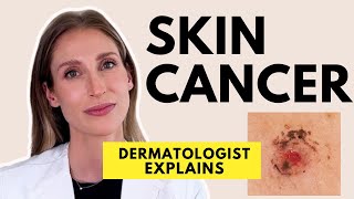 Skin Cancer Different Types Causes Prevention amp Treatments  Dr Sam Ellis [upl. by Salas]