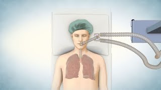 Lung Transplant Process [upl. by Shippee979]