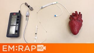 Placing a Transvenous Pacemaker [upl. by Eetsirk653]