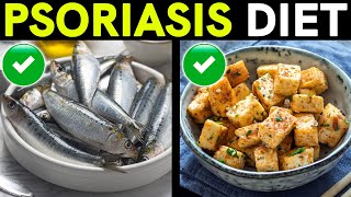 Psoriasis Treatment and Diet Foods to Eat and Avoid [upl. by Ynabe]