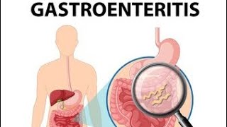 Gastroenteritis Definition of gastroenteritis Causes of gastroenteritis Symptoms💯✨ [upl. by Nmutua376]