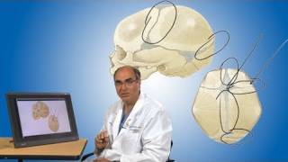 Plagiocephaly and its treatment  Boston Children’s Hospital [upl. by Fafa716]