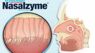 Neti Pots and Nasal irrigation simplified [upl. by Olympie129]