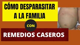 Cómo desparasitar a la familia con remedios caseros [upl. by Cavanagh]