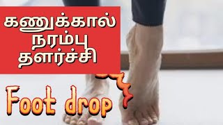 Foot drop exercise peroneal nerve injury [upl. by Kokoruda]