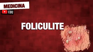 Foliculite bactéria causadora patologia e tratamento [upl. by Eniamsaj521]