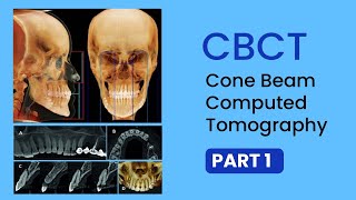 Read CBCT part 1  Basics Uses Interpretations Technical terms of Cone Beam CT Scan [upl. by Munford]