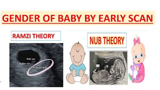 RAMZI THEORY VS NUB THEORY TO KNOW GENDER OF BABY [upl. by Nataniel526]