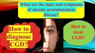 Chronic Granulomatous disease  Autoimmune disease [upl. by Ruttger]