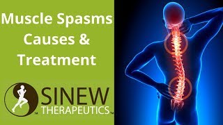 Muscle Spasms Causes and Treatment [upl. by Linzy]