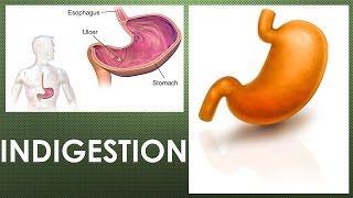 What does indigestion feel like What are the symptoms of functional dyspepsia [upl. by Nehtiek]