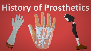 The History Of Prosthetics Explained [upl. by Tice]