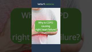 COPD and Heart Failure Whats the Connection ❤️🫁 COPD HeartHealth usmlestep [upl. by Melosa]