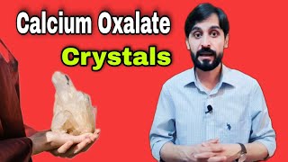 Calcium Oxalate Crystals in Urine  What are Calcium Oxalate Crystals  CausesTreatmentPrevention [upl. by Nallak]