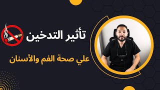 أضرار التدخين على اللثة والأسنان كيف يؤثر التدخين على صحة فمك؟ [upl. by Nihhi]