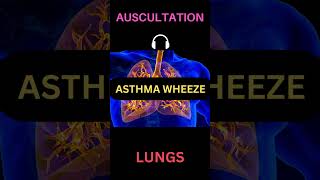 Asthma Wheeze Sounds  Asthma Whistling Sounds shorts medicine medstudent usmle plab asthma [upl. by Hank]