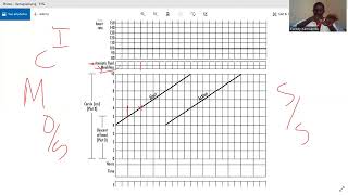 partograph OSCE [upl. by Wit]