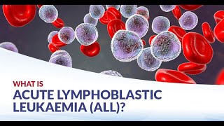 Acute Lymphoblastic Leukemia ALL Cancer of the lymphoid I CausesSymptomComplicationsTreatments [upl. by Fontana555]