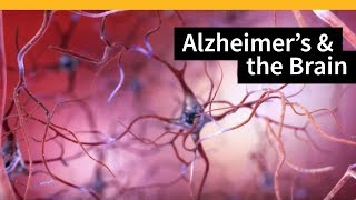 How Alzheimers Changes the Brain [upl. by Yehudit]