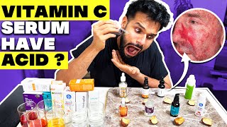 Testing The Best Vitamin C Serum For Indian Skin Shocking Result  BeYourBest Skincare San Kalra​ [upl. by Sedicla]