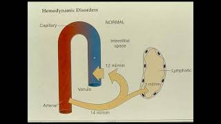 Patología General  Trastornos Hemodinámicos 11 [upl. by Ocirderf]