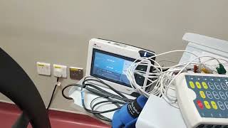 How to Link Suntech BP monitor to WelchAllyn Mortara Xcribe Stress Test machine [upl. by Volny656]