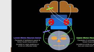 broca s area  broca s aphasia  motor aphasia [upl. by Enywad]