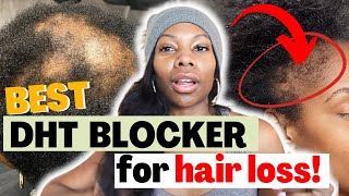 DHT Blockers for Hair Growth Understanding The Hype and The Science [upl. by Nick661]