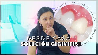 Gingivitis Tratamiento casero  Causas y soluciones [upl. by Palestine735]