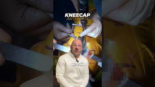 Anterior Knee Pain  What Does It Mean shorts [upl. by Rinna857]