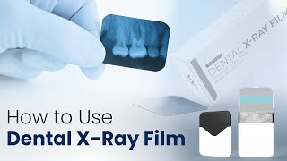 How to use Dental XRay Film  Waldent Dental XRay Film IOPA [upl. by Proudman857]