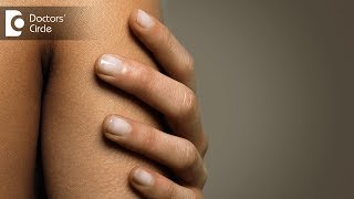 Causes and treatment of brownish fingernails  Dr Amee Daxini [upl. by Tema182]