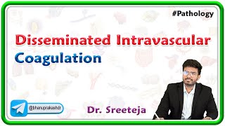 12 Disseminated Intravascular Coagulation DIC  USMLE Step 1 Pathology [upl. by Ahsal450]