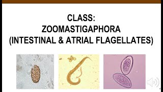 Intestinal amp Atrial Flagellates [upl. by Grissel543]