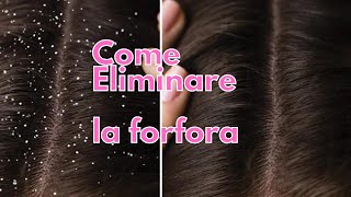 Come eliminare la forfora in 1 solo lavaggio [upl. by Lleda376]