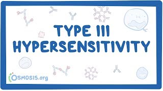 Type III hypersensitivity immune complex mediated  causes symptoms amp pathology [upl. by Fania]