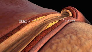 LDL and HDL Cholesterol  Good and Bad Cholesterol  Nucleus Health [upl. by Enomes]