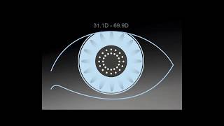 Tip Instructional – Eyesuite Biometry Keratometry [upl. by Desta]