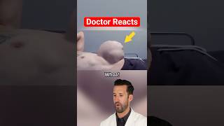 ER Doctor REACTS to the Worlds Largest Hernia [upl. by Atinet]