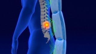 Pulsierende Magnetfeldtherapie Biomag  interessante Informationen für Interessenten [upl. by Nhaj387]