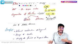 6 Huntingtons Disease Pathology 🧠 USMLE Step 1 [upl. by Stelle49]