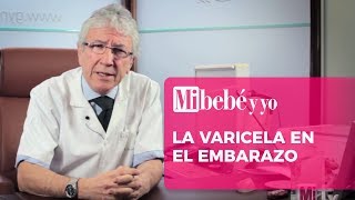 La varicela en el embarazo [upl. by Euqinor]