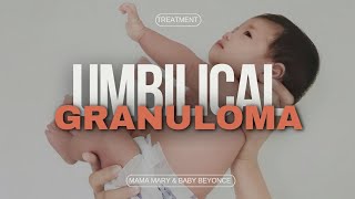 UMBILICAL GRANULOMA TREATMENT babyumbilical infected salt [upl. by Eiro]