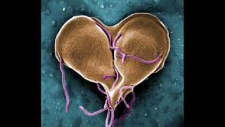 Infectious Disease InfoVid  Giardia [upl. by Ecnarepmet477]