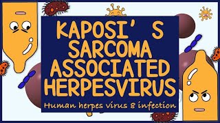 Kaposi Sarcoma Associated Herpes virus HHV 8 Morphology Diagnosis Treatment amp Prevention [upl. by Ecart]