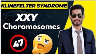 The Genetics of Klinefelters Syndrome What You Need to Know [upl. by Manvil]